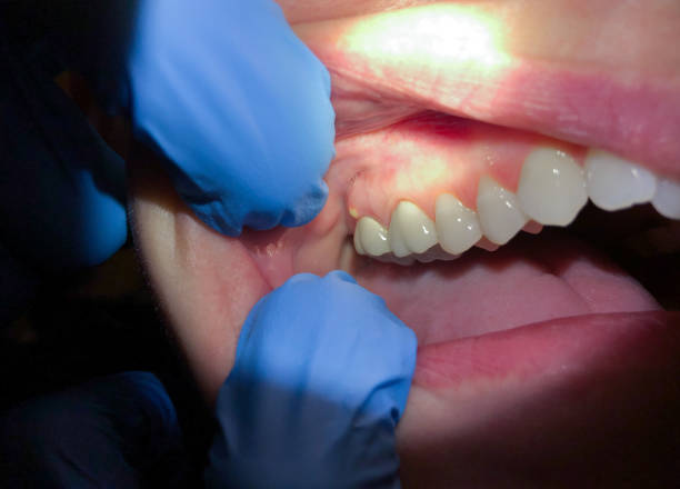 Best Emergency Orthodontic Repairs in Oak Grove, TN